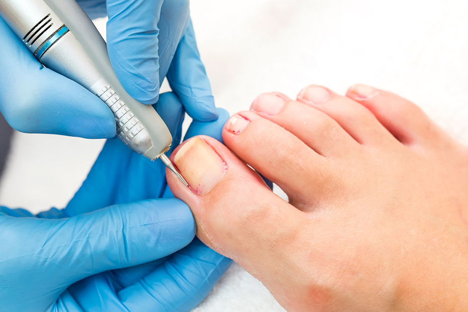 Nail Treatment Doctor in Thane