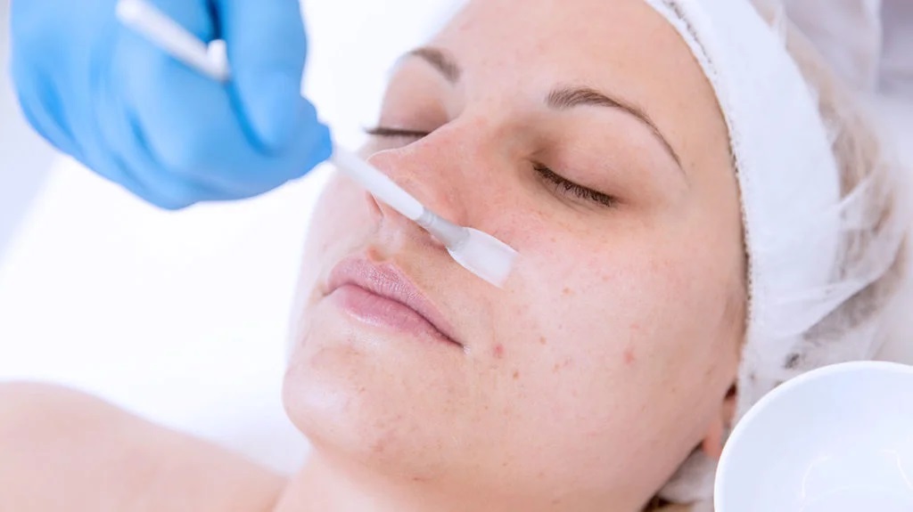 Chemical Peels Doctor in Thane
