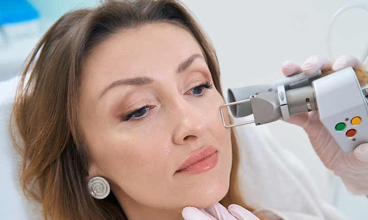 LASER & MNRF FOR ACNE SCAR