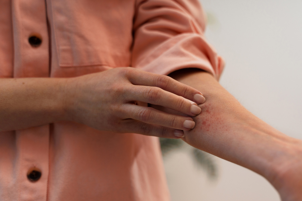 Fungal Skin Infection Treatment in Thane