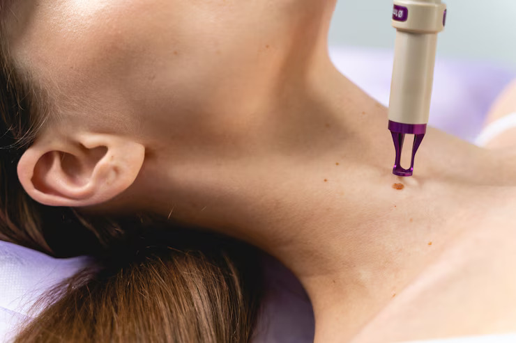Our Dermatology Services in Thane - Dr. Asha Mourya