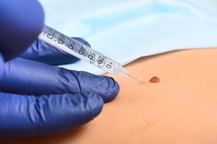 Anesthesia Treatment in Thane - Safe & Advanced Care